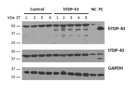 TDP43