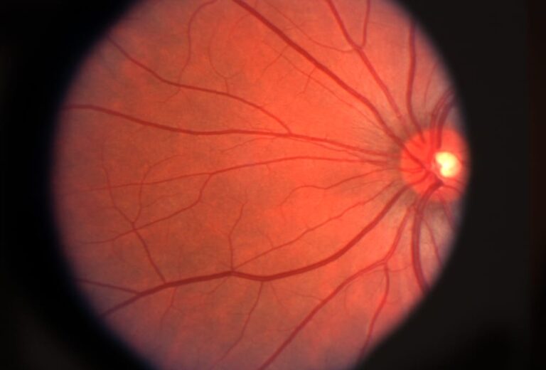 retinal scan image