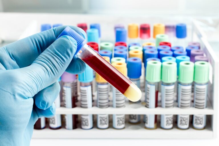lab technician holding blood tube test in front of other tests