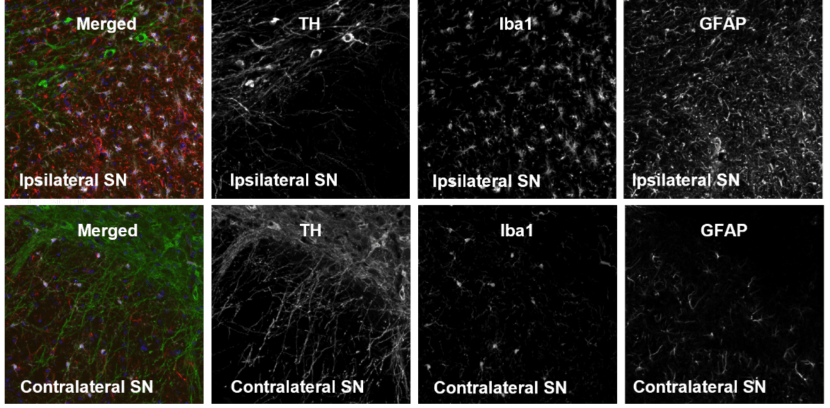 Intrastriatal Rotenone Mouse Model of Parkinson’s Disease