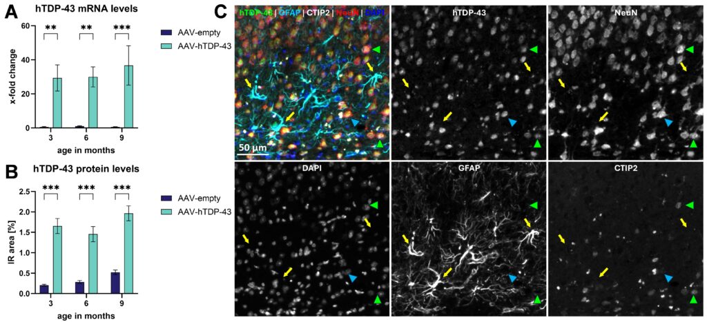 Induced Human TDP-43 Mouse Model Recapitulates