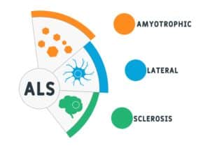 Amyotrophic lateral sclerosis (ALS) graphic illustration