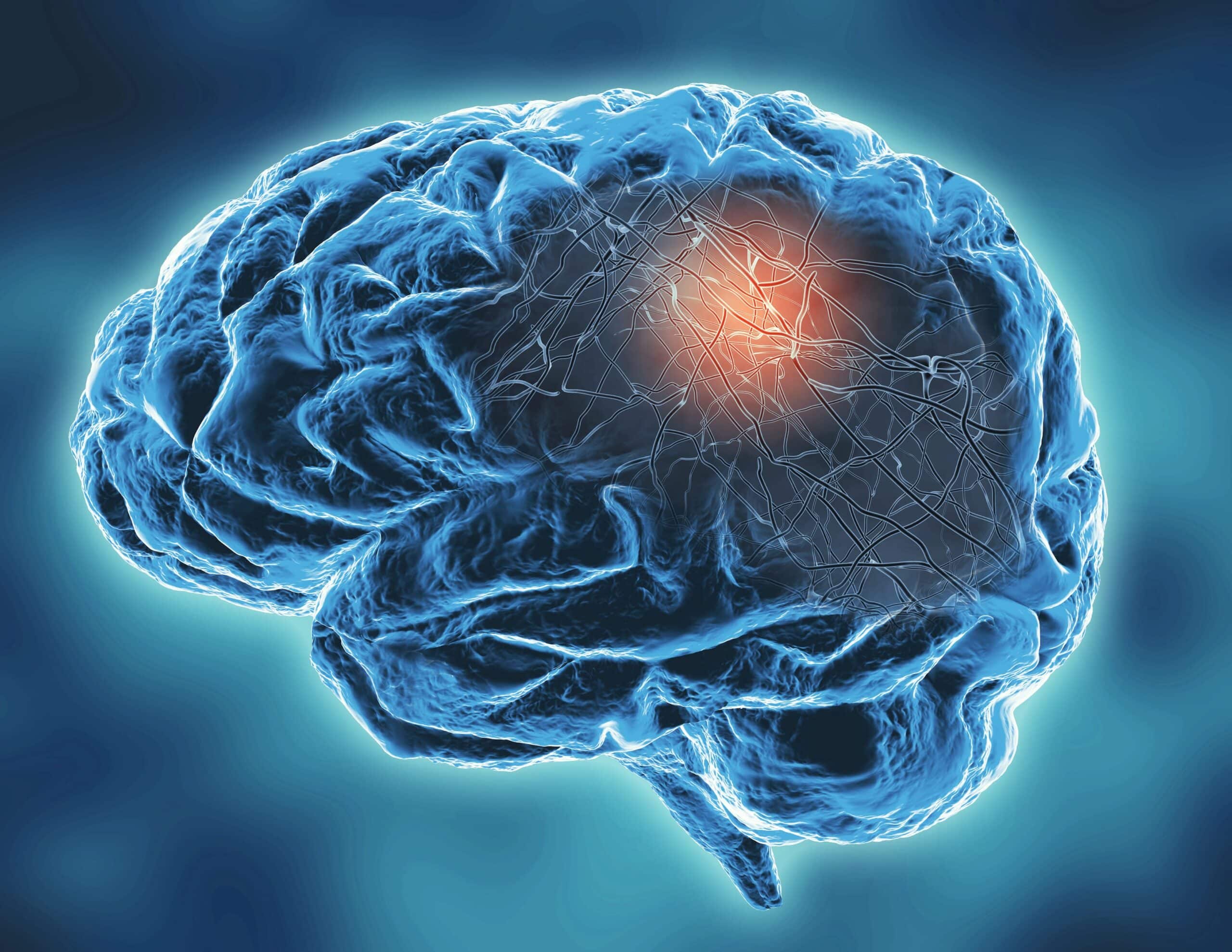 Digital illustration of human brain with orange marking