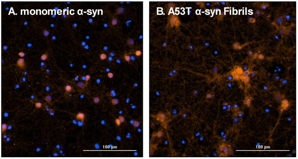 Seeding and Autophagy