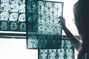 Doctor looking at brain scans